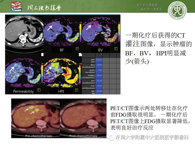 【PPT】肝脏CT灌注在肿瘤学中的原理及应用