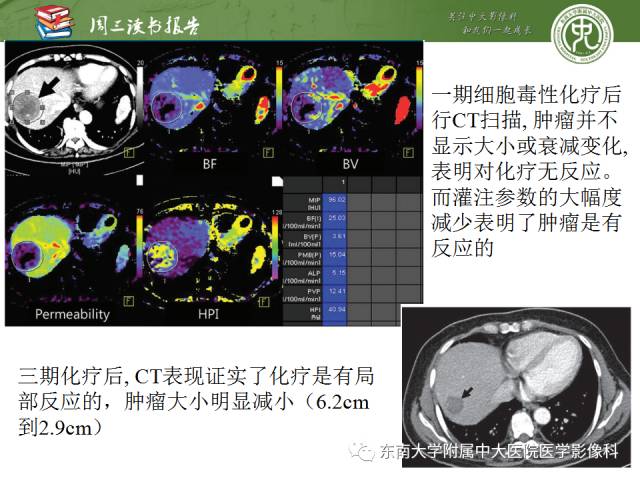 【PPT】肝脏CT灌注在肿瘤学中的原理及应用