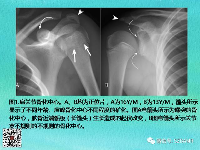 【PPT】儿童骨肌发育变异的影像学诊断