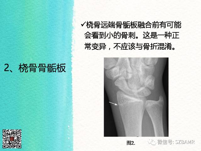 【PPT】儿童骨肌发育变异的影像学诊断