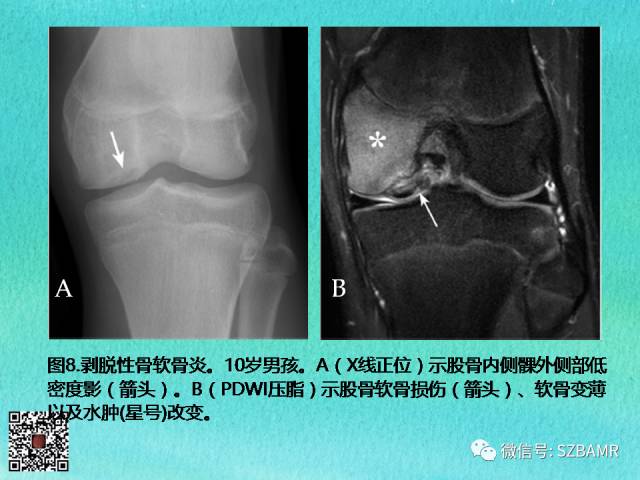 【PPT】儿童骨肌发育变异的影像学诊断
