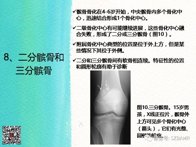 【PPT】儿童骨肌发育变异的影像学诊断