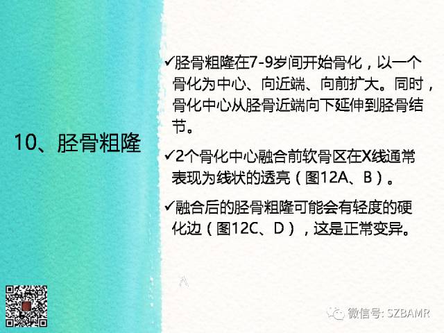 【PPT】儿童骨肌发育变异的影像学诊断