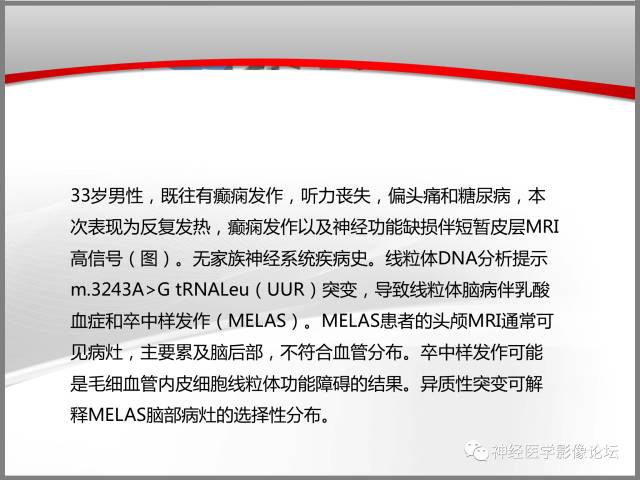 【病例】线粒体脑肌病典型病例一例MR 【病例】线粒体脑肌病典型病例一例MR
