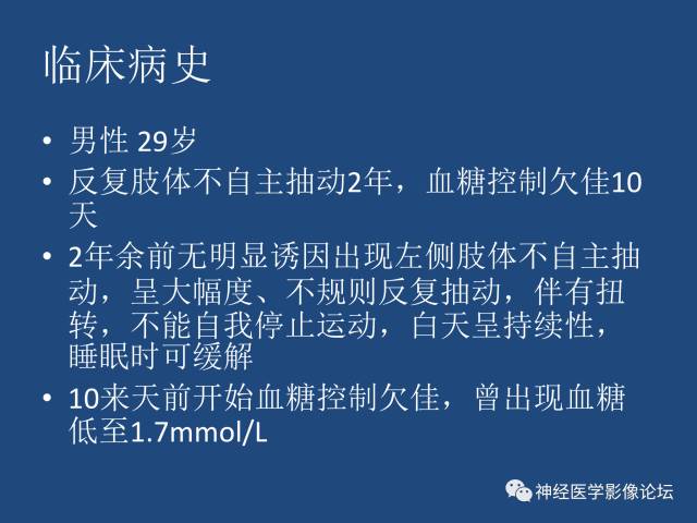 【病例】线粒体脑肌病疑难病例一例MR影像讨论
