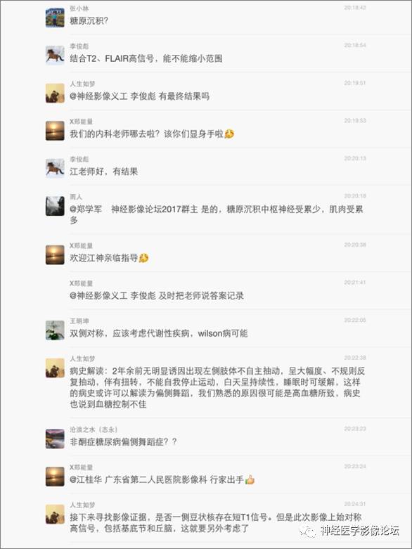 【病例】线粒体脑肌病疑难病例一例MR影像讨论