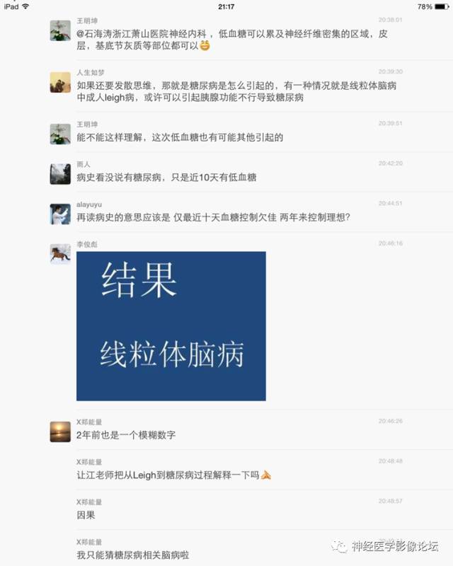 【病例】线粒体脑肌病疑难病例一例MR影像讨论