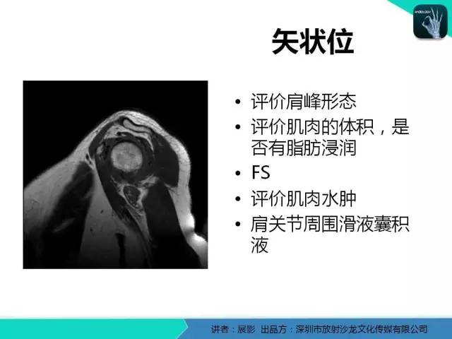 【PPT】肩峰下撞击综合征和肩袖损伤的MR表现
