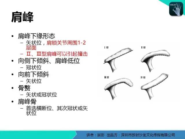 【PPT】肩峰下撞击综合征和肩袖损伤的MR表现