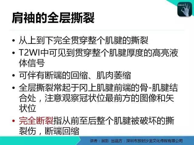 【PPT】肩峰下撞击综合征和肩袖损伤的MR表现