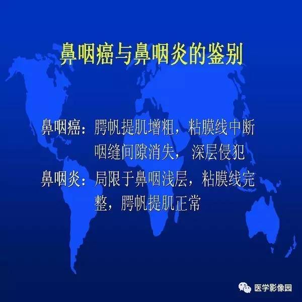 【PPT】鼻咽病变诊断与鉴别诊断