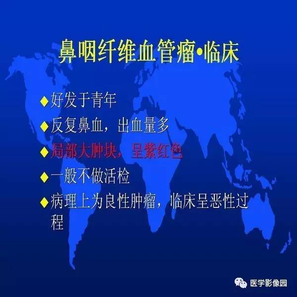 【PPT】鼻咽病变诊断与鉴别诊断