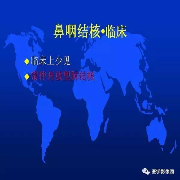【PPT】鼻咽病变诊断与鉴别诊断