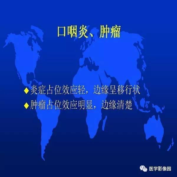 【PPT】鼻咽病变诊断与鉴别诊断