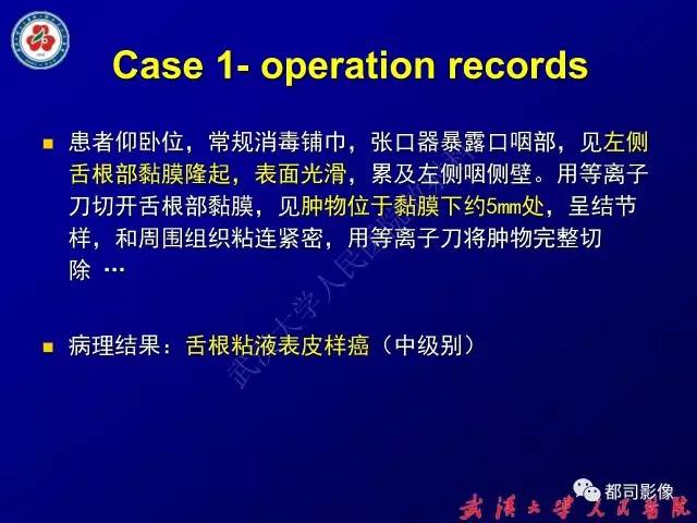 【PPT】舌部良恶性病变及鉴别诊断