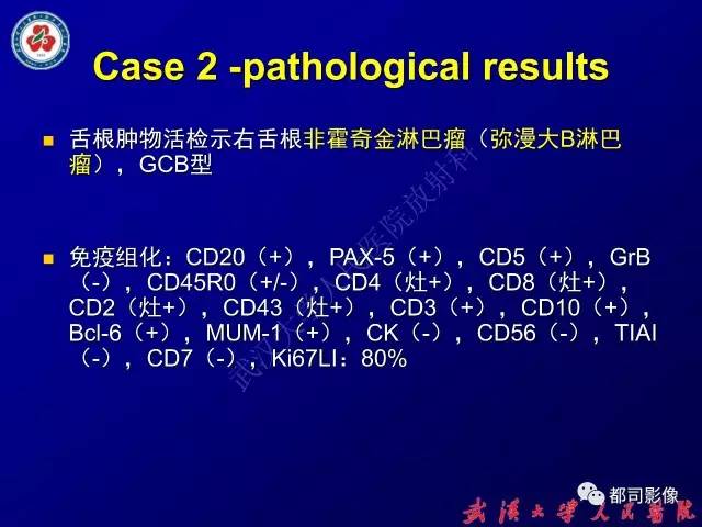 【PPT】舌部良恶性病变及鉴别诊断