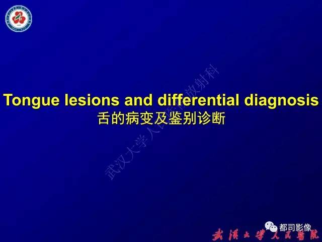 【PPT】舌部良恶性病变及鉴别诊断