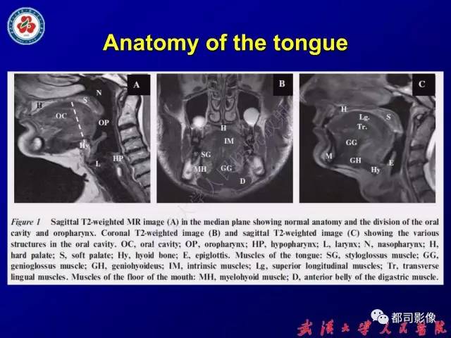 【PPT】舌部良恶性病变及鉴别诊断