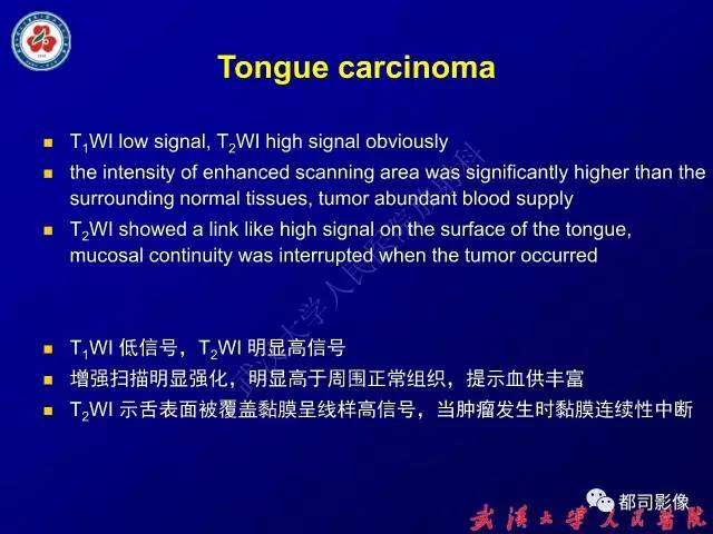 【PPT】舌部良恶性病变及鉴别诊断