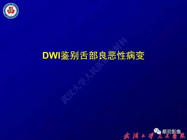 【PPT】舌部良恶性病变及鉴别诊断