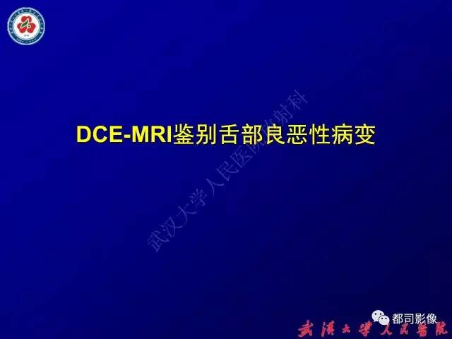 【PPT】舌部良恶性病变及鉴别诊断