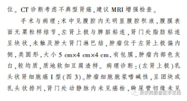 【病例】乳头状肾细胞癌1例CT影像表现