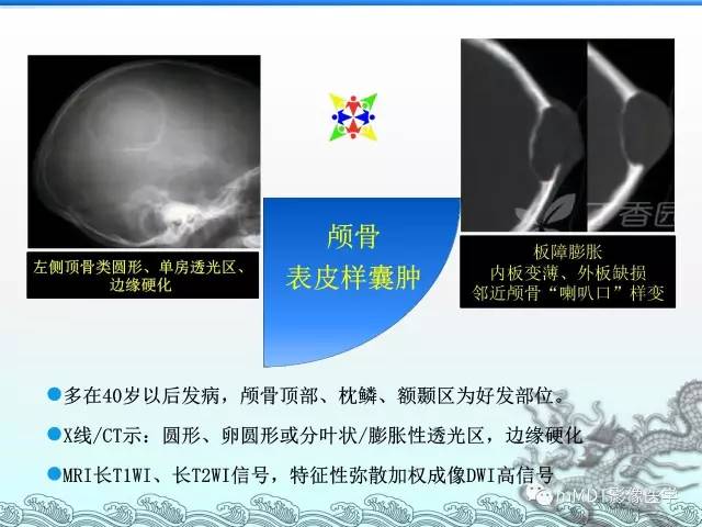 【PPT】骨嗜酸性肉芽肿的影像诊断