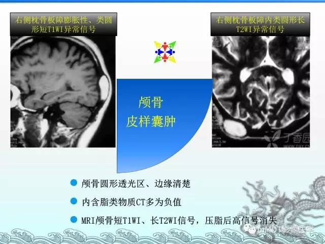 【PPT】骨嗜酸性肉芽肿的影像诊断