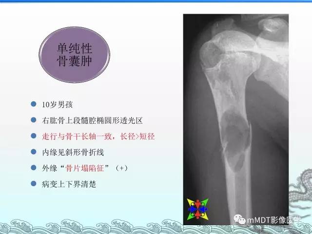 【PPT】骨嗜酸性肉芽肿的影像诊断