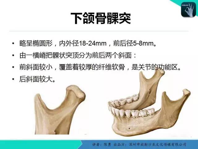 【PPT】颞下颌关节紊乱的MRI诊断
