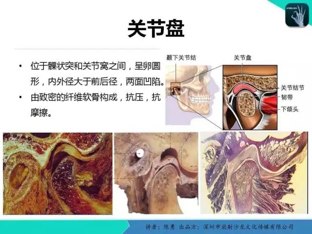 【PPT】颞下颌关节紊乱的MRI诊断