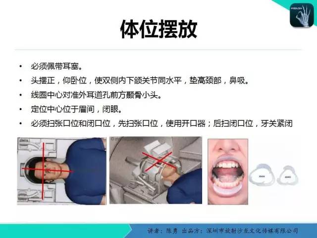 【PPT】颞下颌关节紊乱的MRI诊断