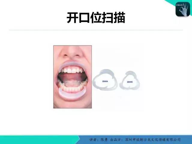 【PPT】颞下颌关节紊乱的MRI诊断