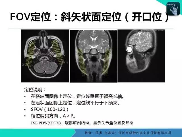 【PPT】颞下颌关节紊乱的MRI诊断