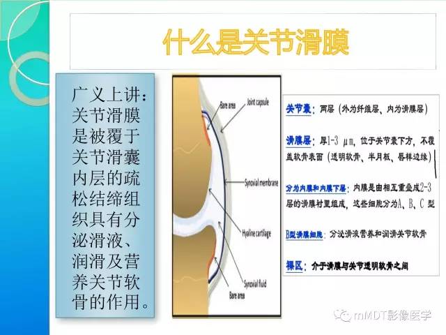 【PPT】7种累及关节滑膜的病变你GET了吗