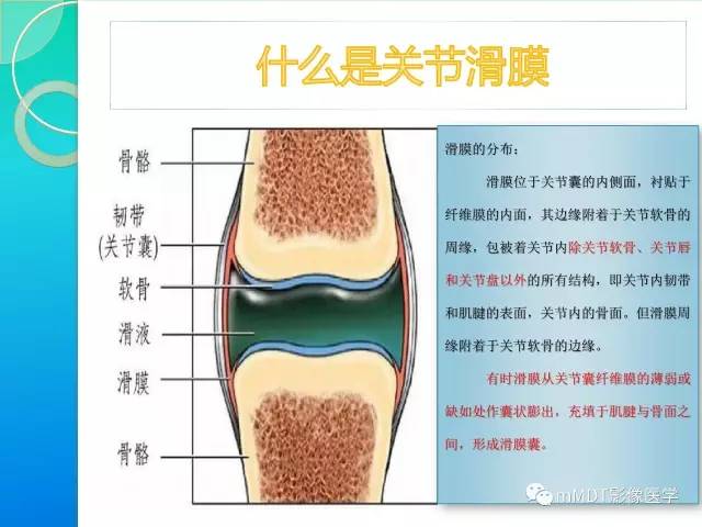 【PPT】7种累及关节滑膜的病变你GET了吗