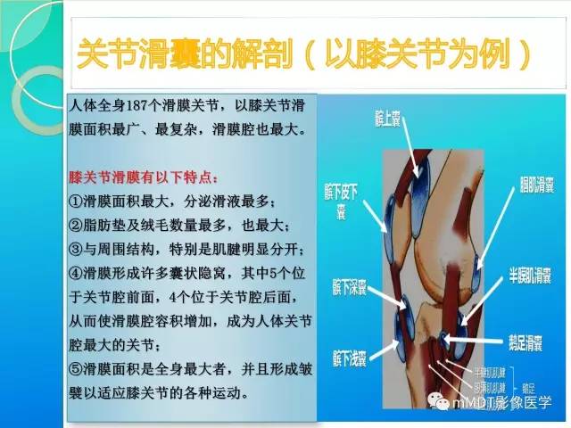 【PPT】7种累及关节滑膜的病变你GET了吗
