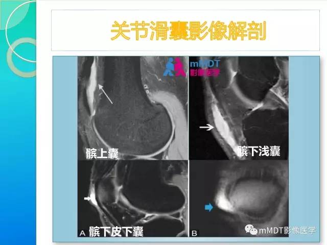 【PPT】7种累及关节滑膜的病变你GET了吗