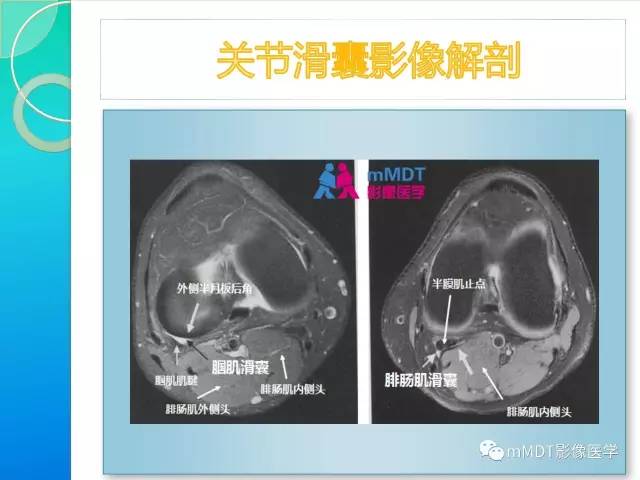 【PPT】7种累及关节滑膜的病变你GET了吗
