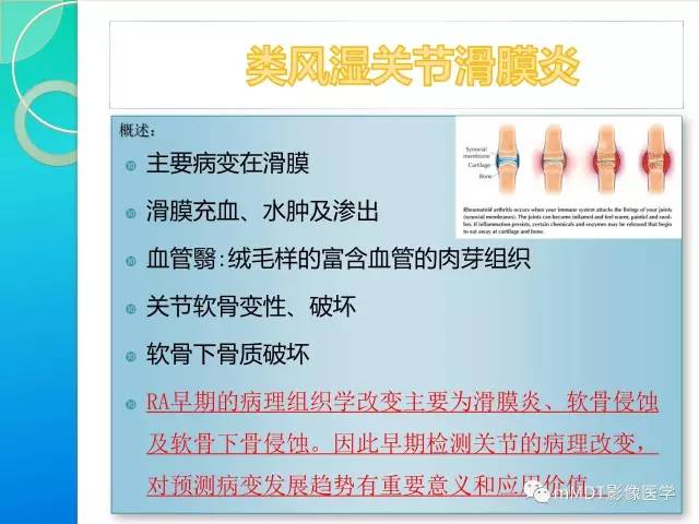 【PPT】7种累及关节滑膜的病变你GET了吗
