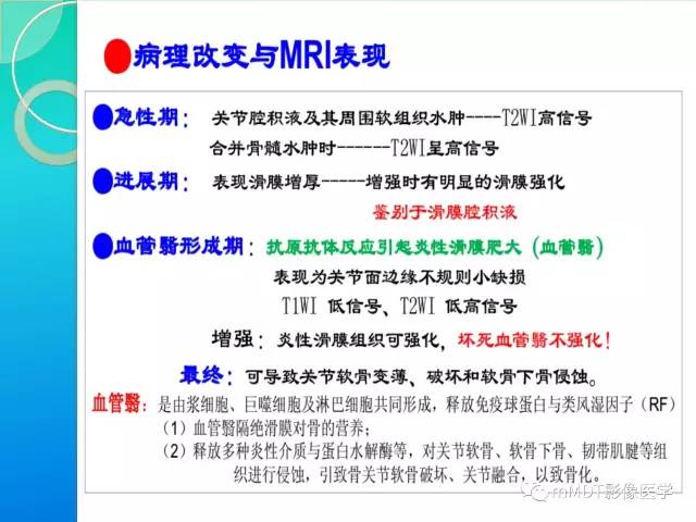 【PPT】7种累及关节滑膜的病变你GET了吗