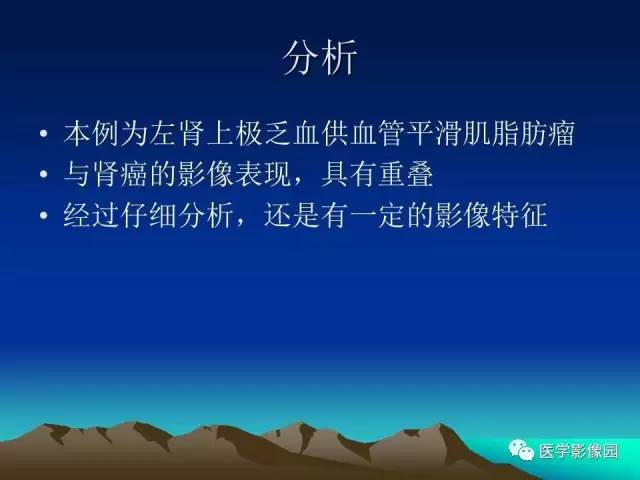 【病例】左肾乏脂肪型血管平滑肌脂肪瘤1例
