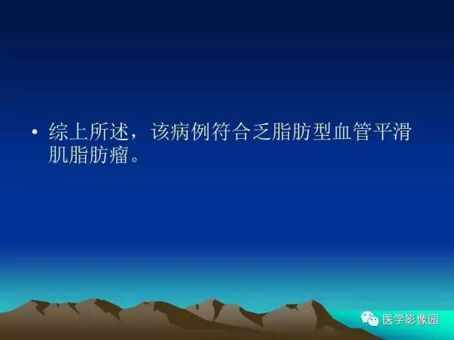 【病例】左肾乏脂肪型血管平滑肌脂肪瘤1例