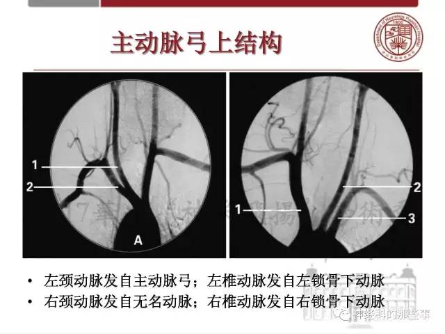 【PPT】脑血管病的影像诊断基础
