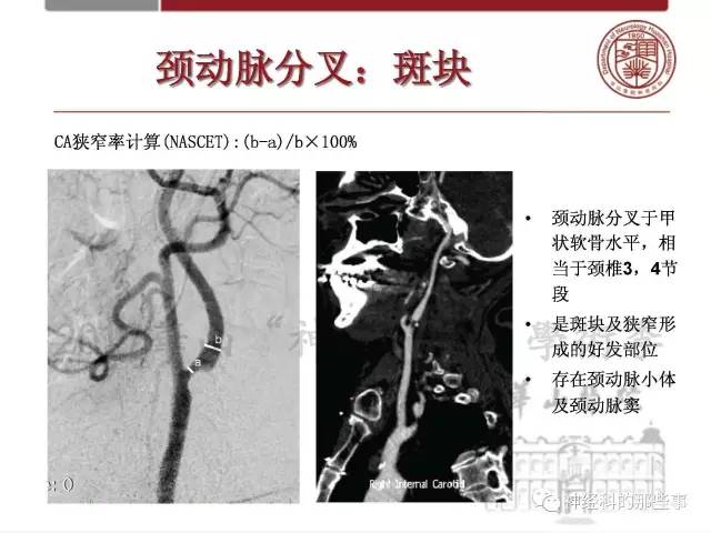 【PPT】脑血管病的影像诊断基础