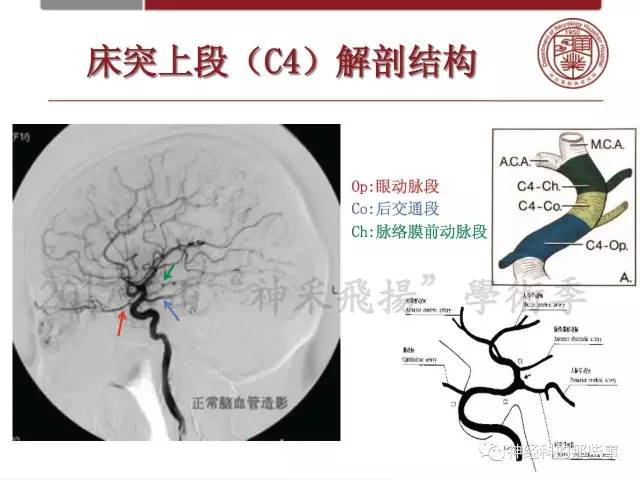 【PPT】脑血管病的影像诊断基础