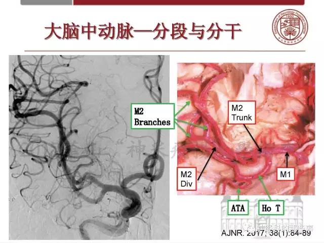 【PPT】脑血管病的影像诊断基础