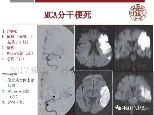【PPT】脑血管病的影像诊断基础