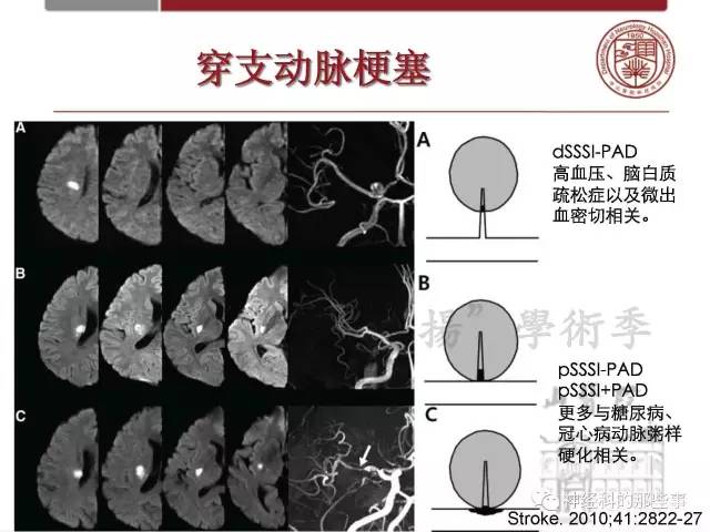 【PPT】脑血管病的影像诊断基础