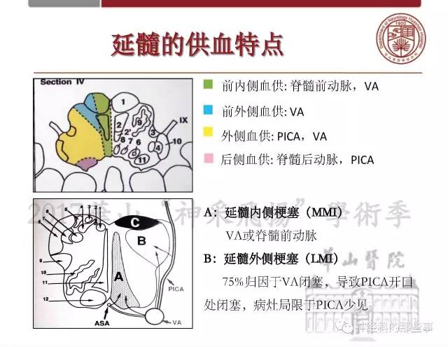 【PPT】脑血管病的影像诊断基础